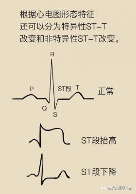 老t是什么（老T是什么意思?）-图3