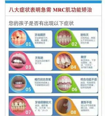 mrc是什么意思（牙科mrc是什么意思）-图3