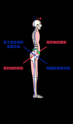 什么是骨岔（什么是骨盆前倾）-图1