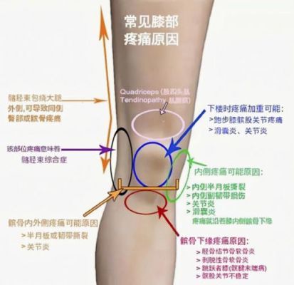 漆盖疼挂什么科（漆盖关节疼做什么检查）-图2